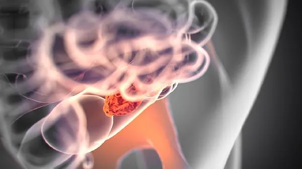 牛肠怎么清洗去臭味插图1